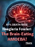 A woman in Texas has died after contracting a rare infection caused by a brain-eating amoeba, which she encountered while using tap water to rinse her sinuses at a campground. ''If water containing the ameba goes up the nose and to the brain, it can cause an infection called primary amebic meningoencephalitis (PAM),'' the CDC explained. ''Typically, fewer than 10 people a year in the United States get PAM. Nearly everyone who gets PAM dies from it''. 